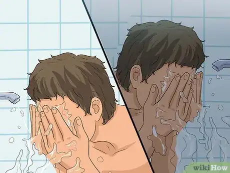 Imagen titulada Get Rid of Acne Redness Step 2