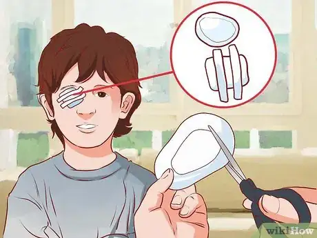 Imagen titulada Get Rid of a Lazy Eye Step 21