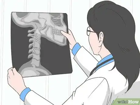 Imagen titulada Treat Crepitus Step 10
