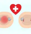hacerse un piercing en el pezón