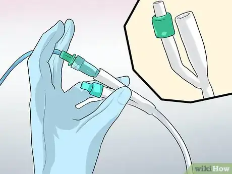 Imagen titulada Remove a Catheter Step 5