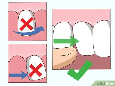 Imagen titulada Loosen a Tooth Step 2