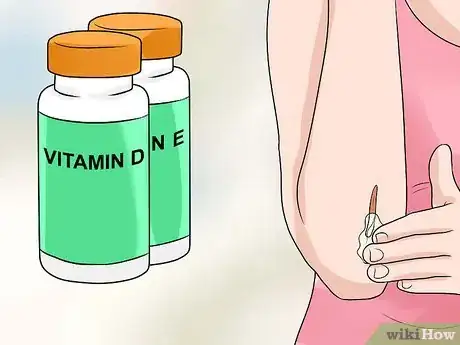 Imagen titulada Remove Keloid Scars at Home Step 9