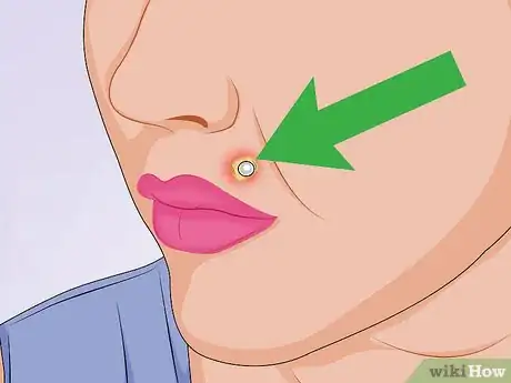 Imagen titulada Tell if a Piercing Is Infected Step 5