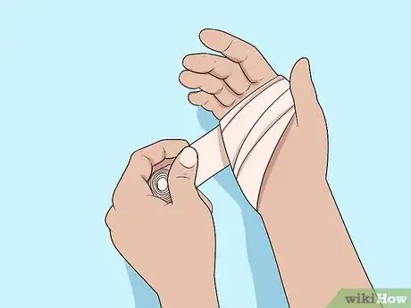 Imagen titulada Prevent Cellulitis Step 4