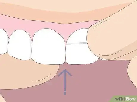 Imagen titulada Floss Step 5