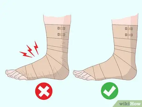 Imagen titulada Wrap an Ankle with an ACE Bandage Step 8