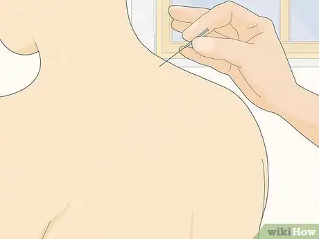 Imagen titulada Fix Torticollis Step 8
