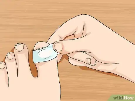 Imagen titulada Relieve Ingrown Toe Nail Pain Step 11