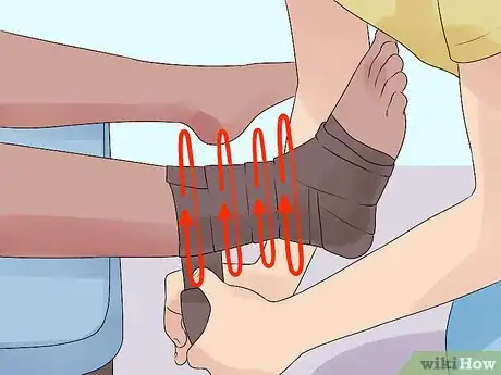 Imagen titulada Tape an Ankle Like an Athletic Trainer Step 12