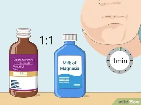 Imagen titulada Heal a Bitten Tongue Step 9