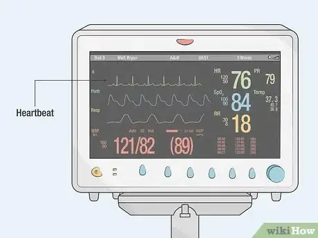 Imagen titulada Read an ICU Monitor Step 6