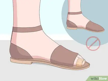 Imagen titulada Relieve Ingrown Toe Nail Pain Step 12
