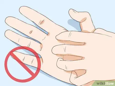 Imagen titulada Identify Warts Step 16
