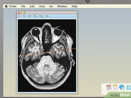 Imagen titulada Read an MRI Step 10