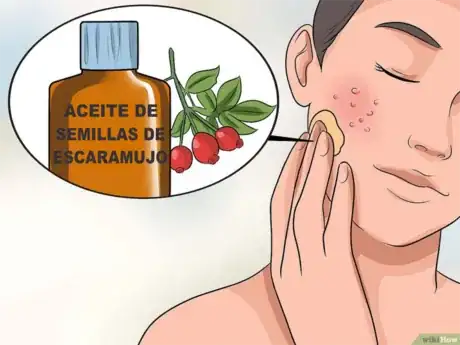 Imagen titulada Get_Rid_of_Large_Pores_and_Blemishes_Step_12