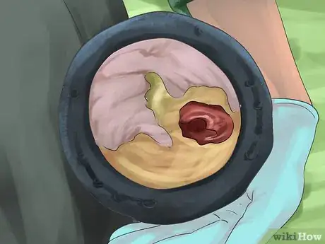Imagen titulada Treat a Hoof Abscess in Horses Step 4