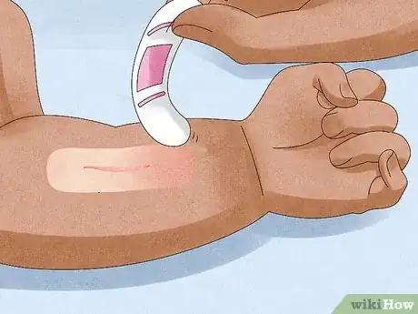 Imagen titulada Remove a Bandage from a Baby Step 7