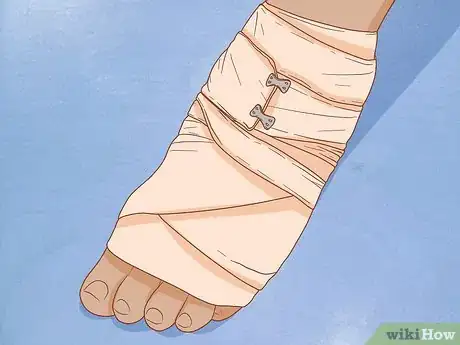 Imagen titulada Apply Different Types of Bandages Step 10