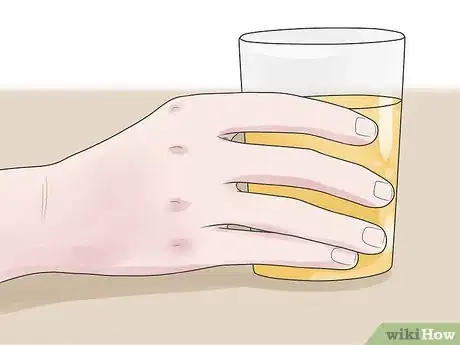 Imagen titulada Soothe an Itchy Throat Step 5