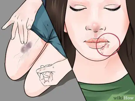 Imagen titulada Tell if Someone Is High Step 7