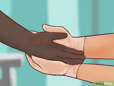 Imagen titulada Treat a Snake Bite Step 15