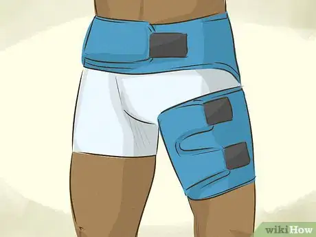 Imagen titulada Treat a Groin Injury Step 3