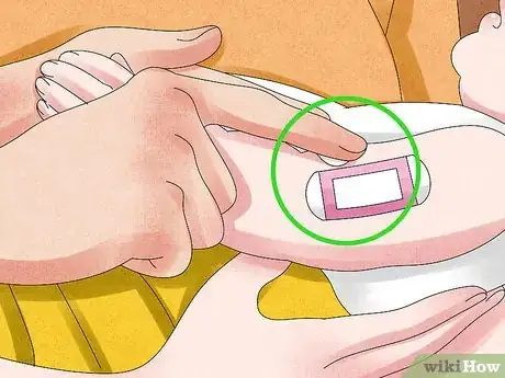Imagen titulada Remove a Bandage from a Baby Step 3