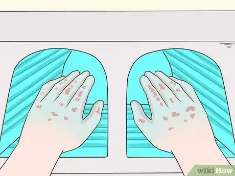 Imagen titulada Cure Lichen Planus Step 9