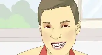 verte genial con brackets