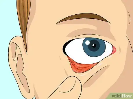 Imagen titulada Put In and Take Out Contacts Step 4