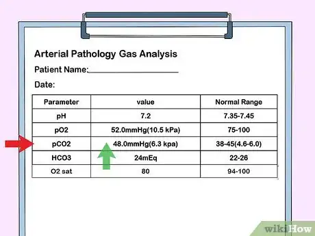 Imagen titulada Interpret Blood Gas Results Step 4
