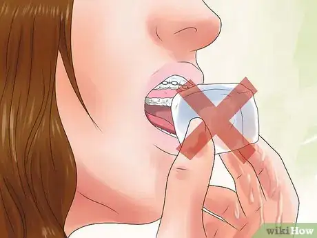 Imagen titulada Eat With Braces Step 4