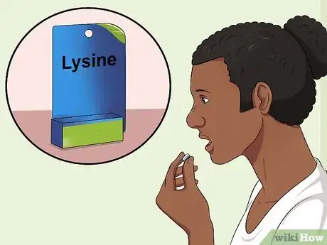Imagen titulada Heal Cold Sores Step 5