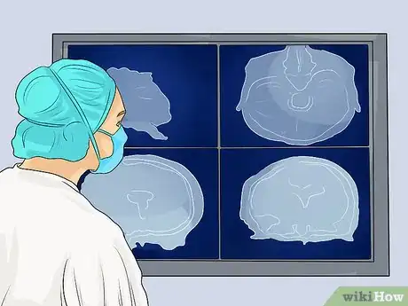Imagen titulada Act Immediately to Lessen Brain Damage from a Stroke Step 2