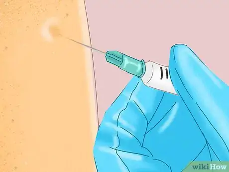 Imagen titulada Relieve Wrist Pain Step 9