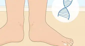 corregir los pies de pato en adultos