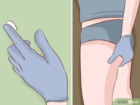 Imagen titulada Relax Your Sphincter Muscle Step 5