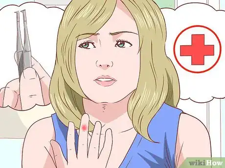 Imagen titulada Remove a Splinter Step 1