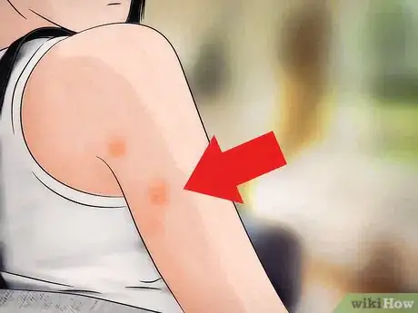 Imagen titulada Identify a Bed Bug Infestation Step 9