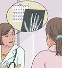 saber si tienes un esguince en el dedo