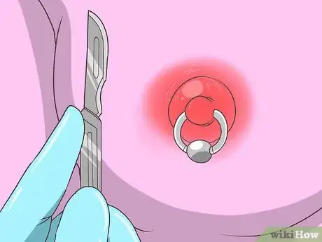 Imagen titulada Treat an Infected Nipple Piercing Step 11