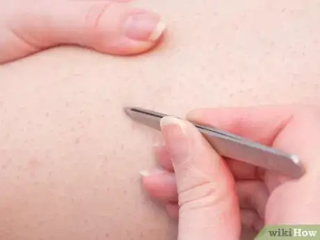 Imagen titulada Prevent Ingrown Hairs on Your Legs Step 8