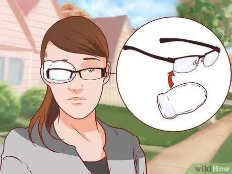 Imagen titulada Get Rid of a Lazy Eye Step 22