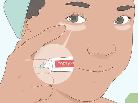 Imagen titulada Make Your Eyes Water Step 2