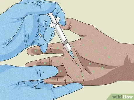 Imagen titulada Stop Sweaty Hands While Gaming Step 8