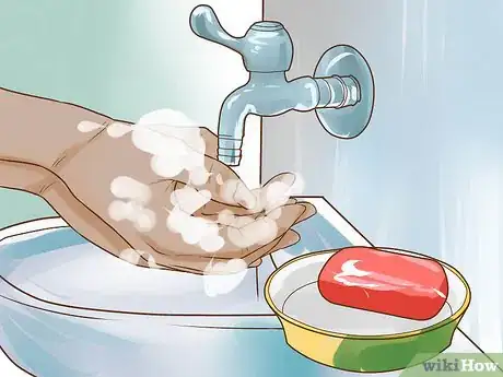 Imagen titulada Check a Cervix for Dilation Step 2
