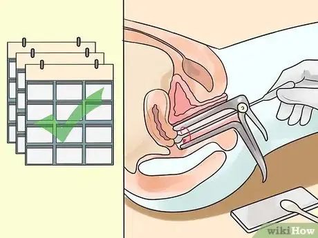 Imagen titulada Get Rid of a Cyst Step 11