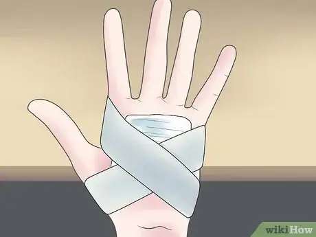 Imagen titulada Treat a Deep Scrape Step 5