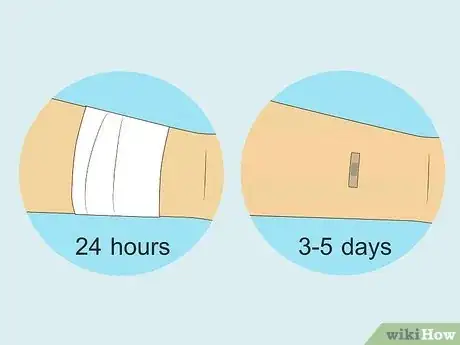 Imagen titulada Remove Nexplanon Step 12